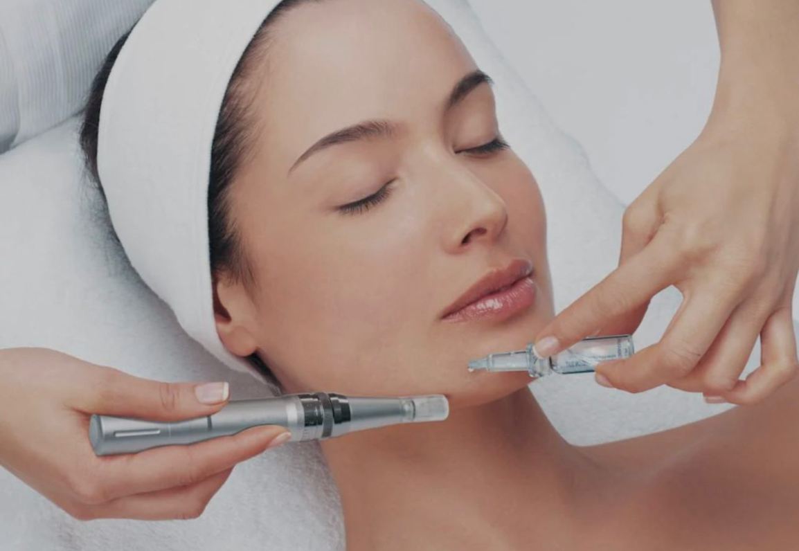 Microneedling Training ( $1400 )
